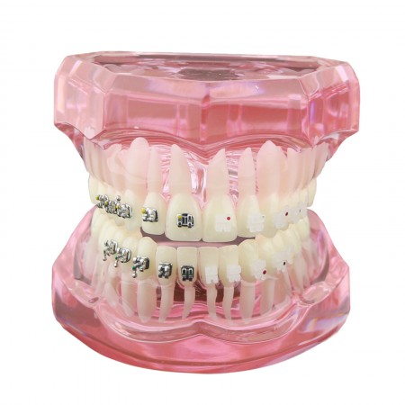 YZDKJDZ Modèle De Dents, Modèle De Dent Orale Orthodontique avec 32 Dents  Amovibles, Modèle De Gencive Molle pour Typodont, pour Démonstration De